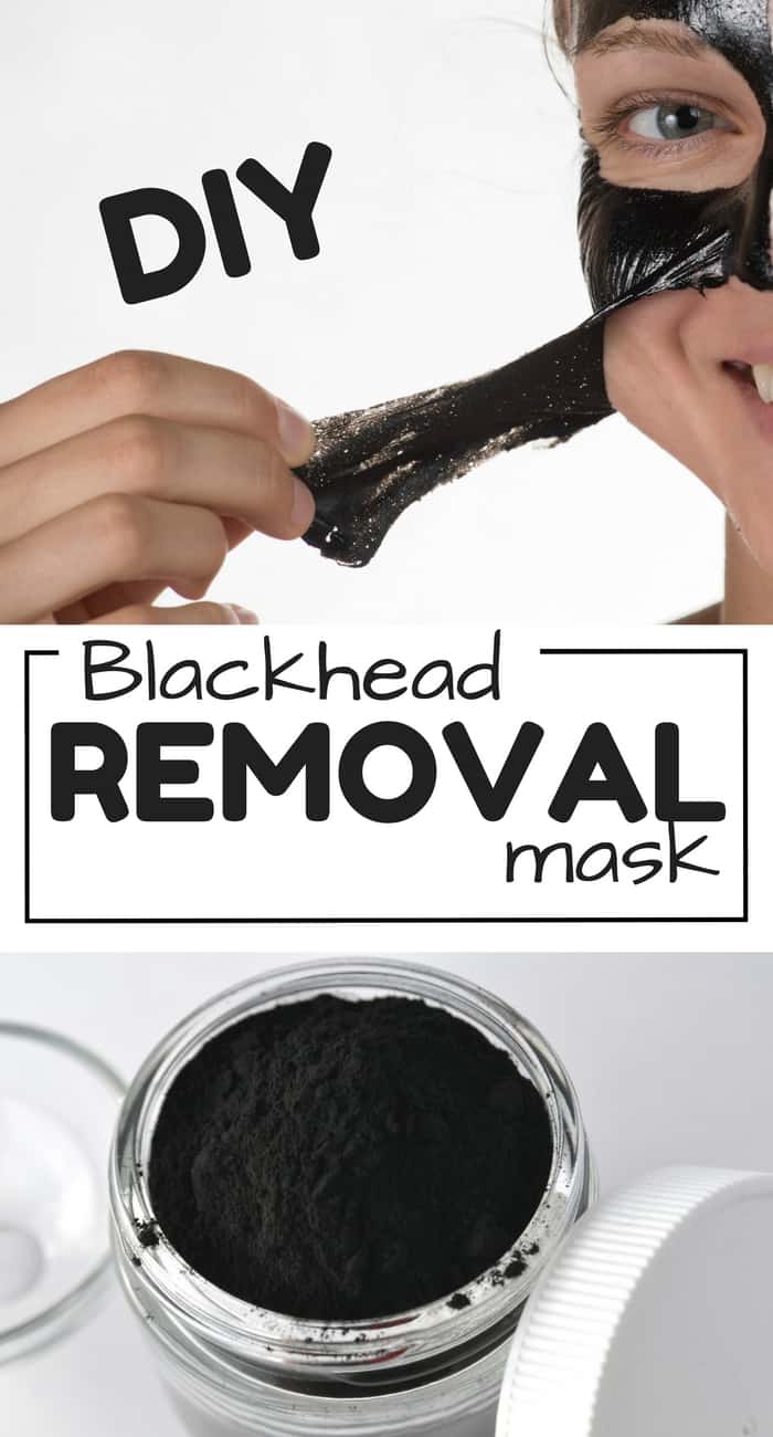 DIY Blackhead removal mask to get rid of blackheads most effectively